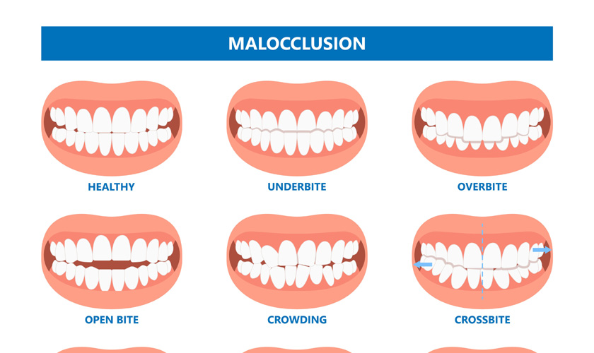 Dental emergency at Advanced Family Cosmetic Dentistry