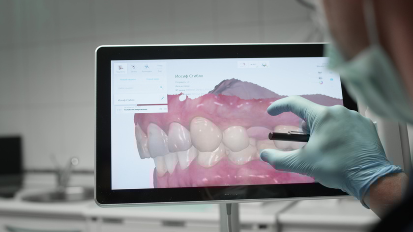 A professional dentist man looks at a 3d model of teeth on a computer monitor. Dental consultation, diagnostics. Jaw scan, digital imprint, medical digital technology.