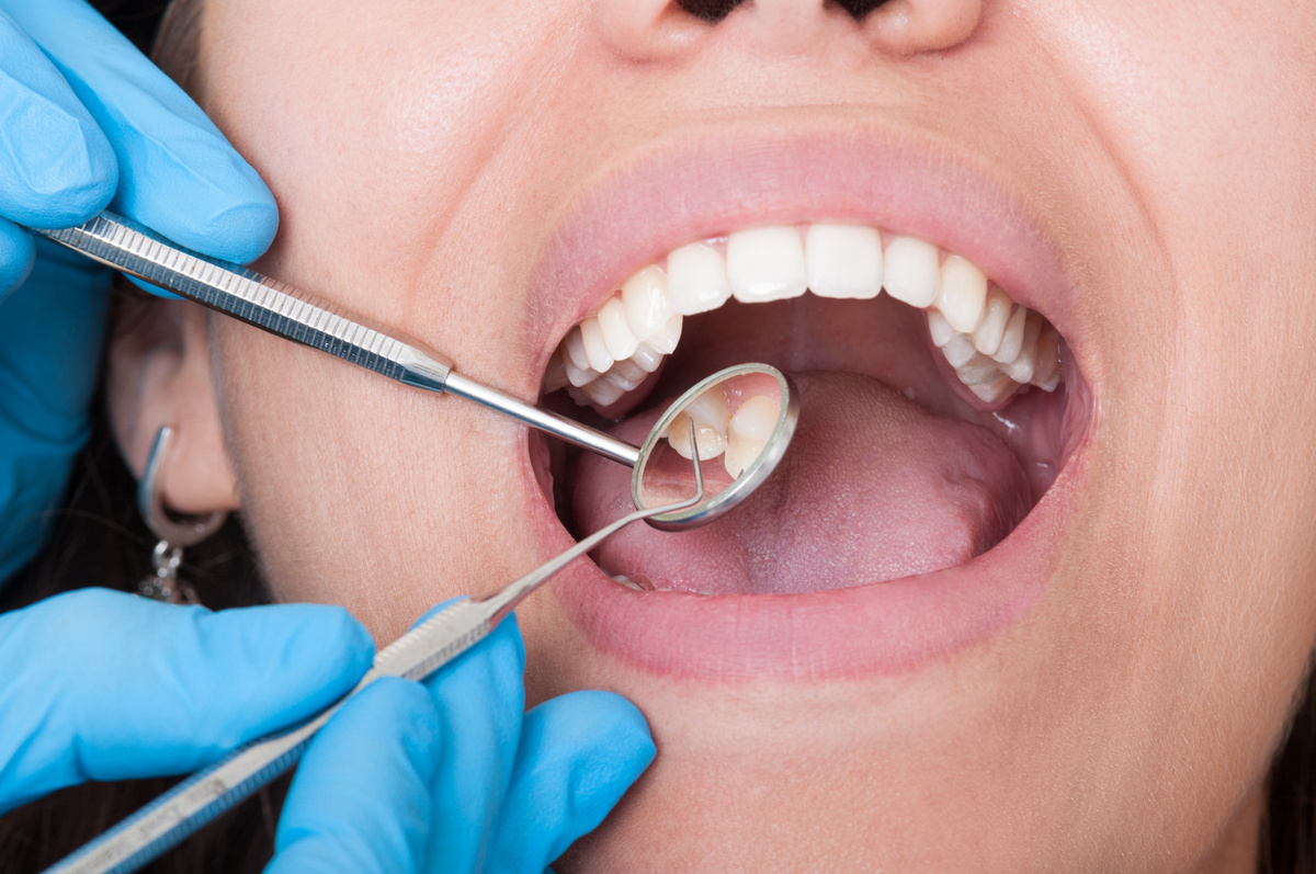 Dental emergency at Advanced Family Cosmetic Dentistry